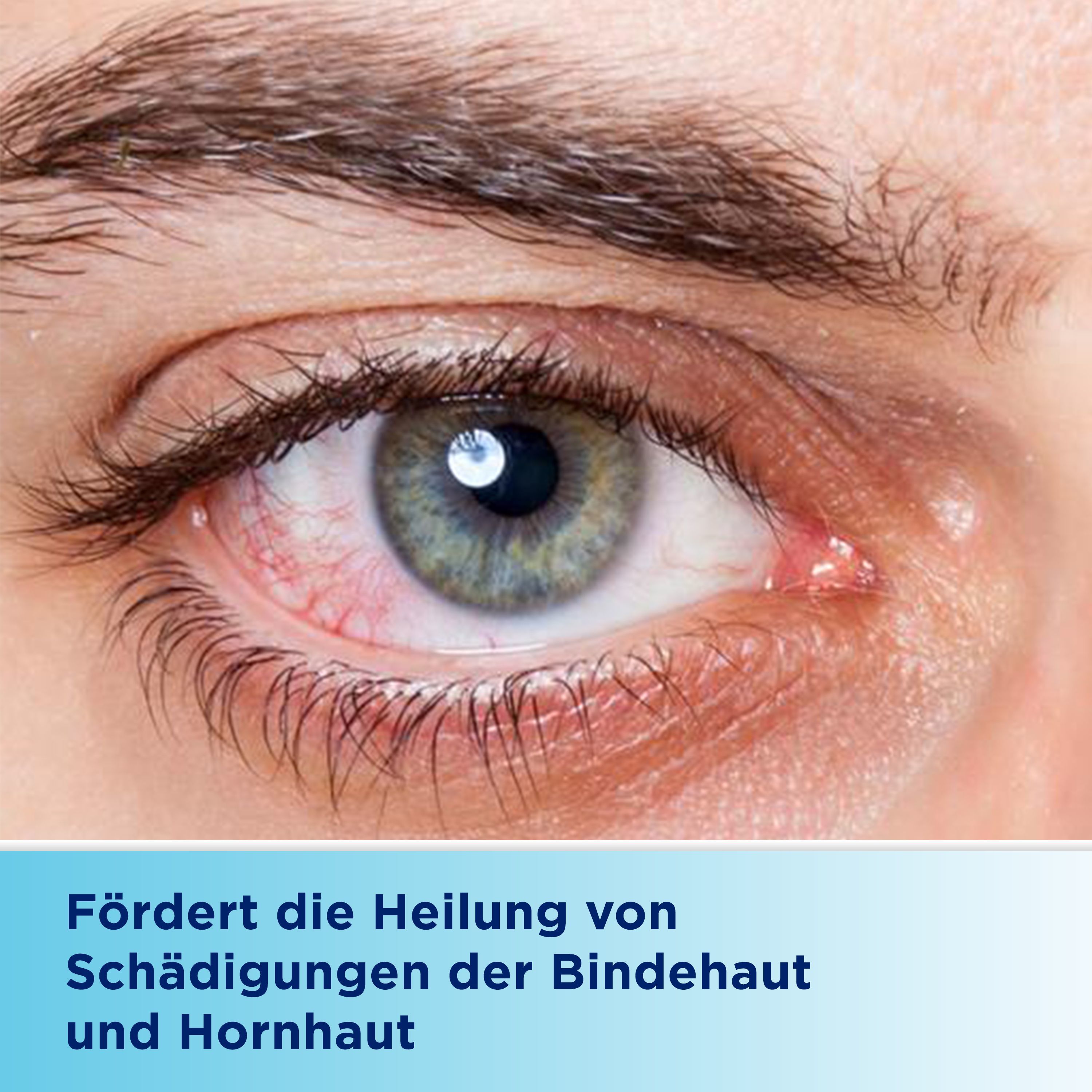 Bepanthen® Augen- und Nasensalbe - Jetzt 15% Rabatt mit dem Code 15bepanthen sparen*